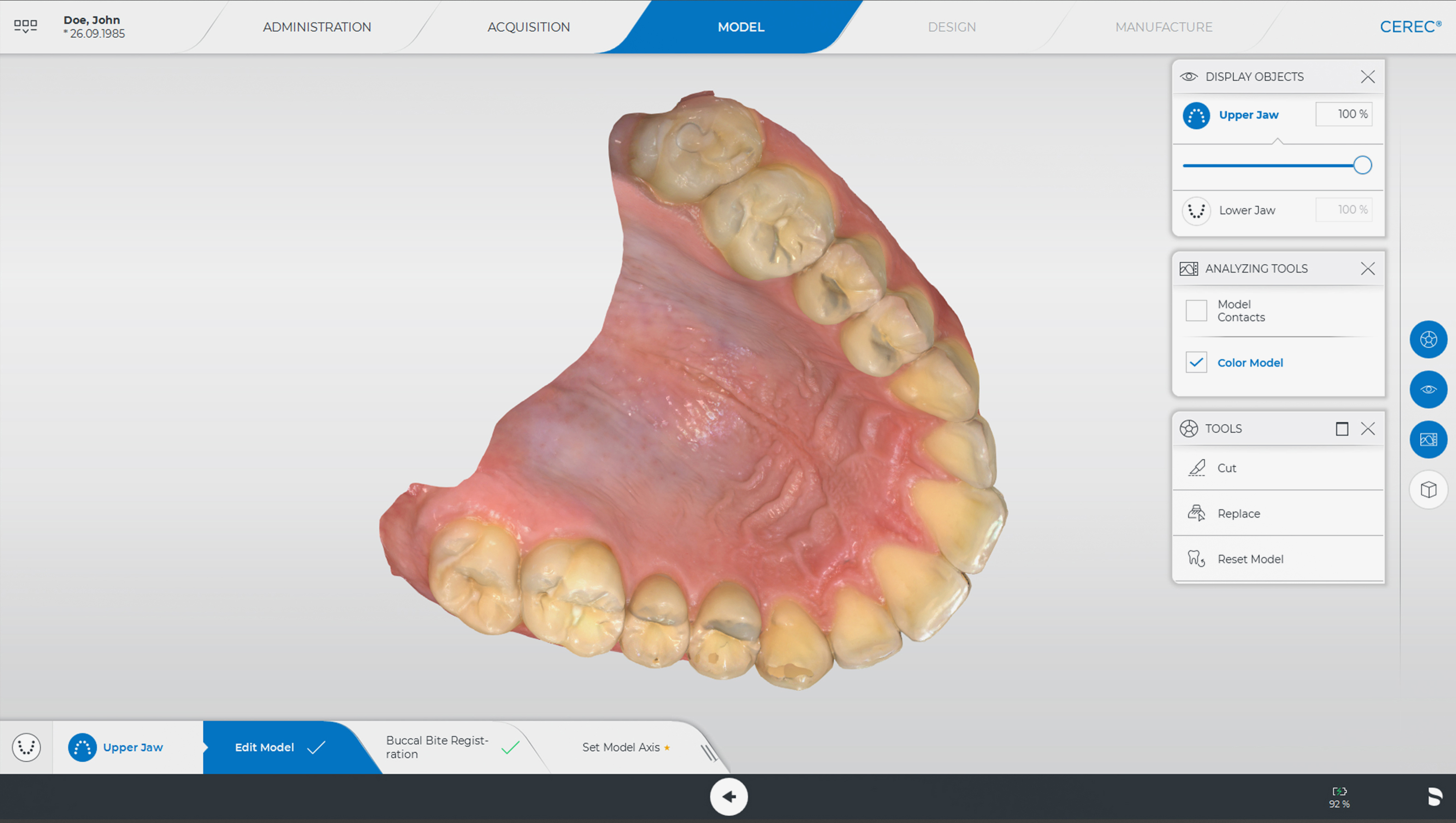 口腔内スキャナーで取得した歯の3Dデータ